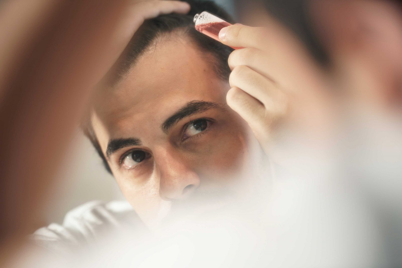 Can Low Testosterone Cause Hair Loss? - UltraCorePower