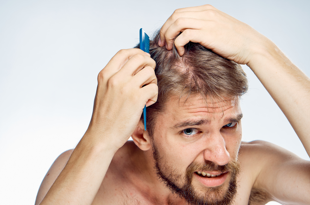 Can Low Testosterone Cause Hair Loss UltraCorePower